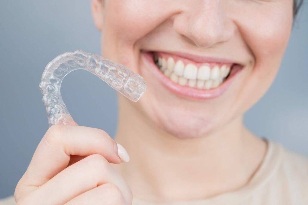Clear Aligners