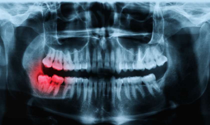 Best Dentist