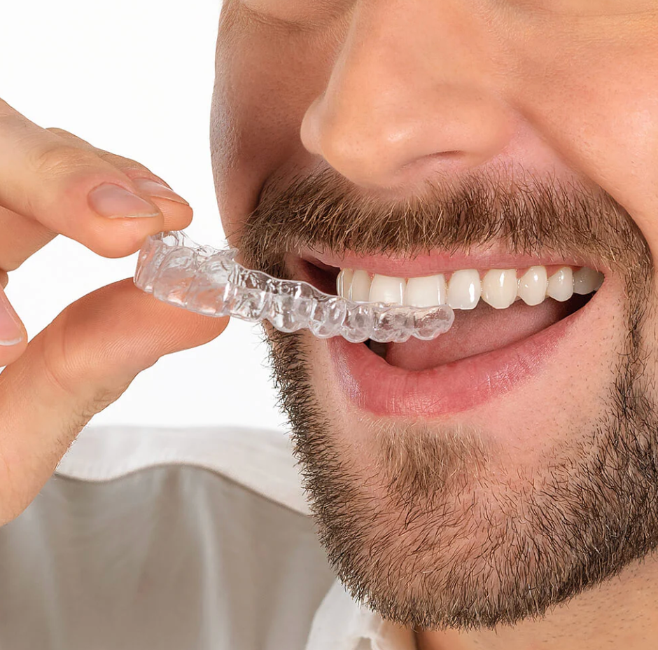 Invisalign Clear Aligners