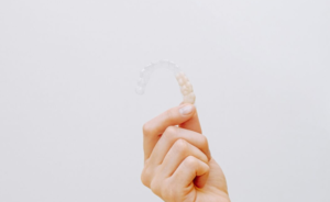 Difference Between Braces and Aligners?