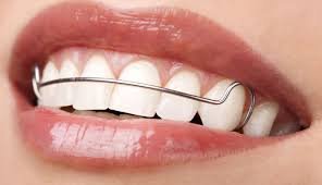 Best Orthodontist in MG Road
