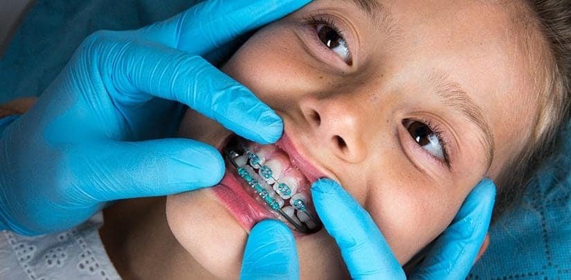Orthodontist for Children