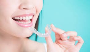 Invisalign