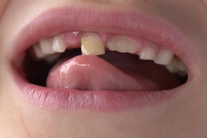Teeth