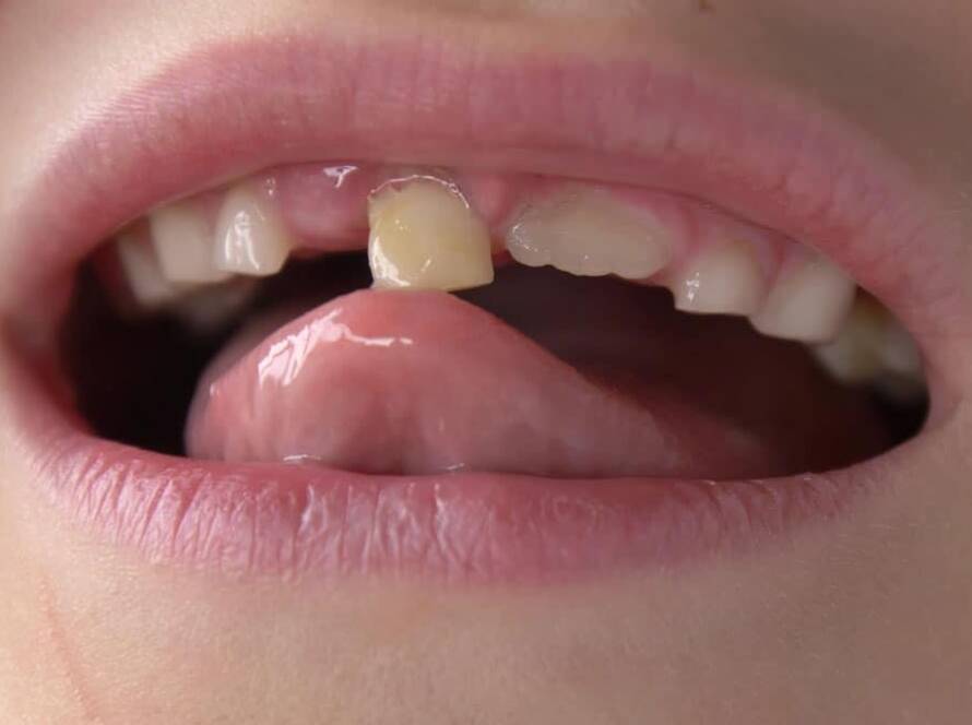 Teeth