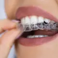 Invisalign Cost in Cunningham Road