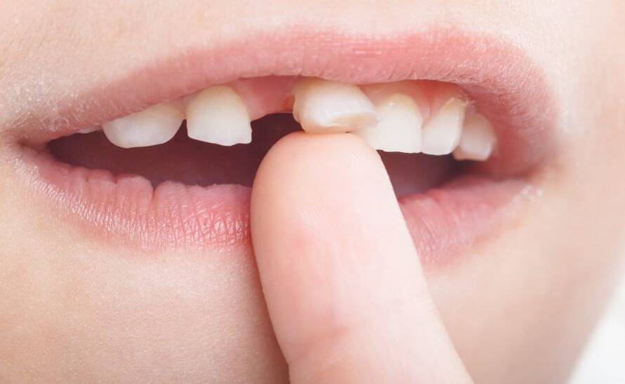 teeth