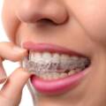 Who Should Visit an Invisalign Clinic?
