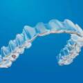 Who Can Get Invisalign Treatment In Bangalore?