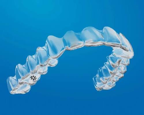 Invisalign Treatment