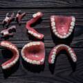 Who needs dentures treatment?