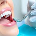 How Often Should You Get Your Teeth Professionally Cleaned?